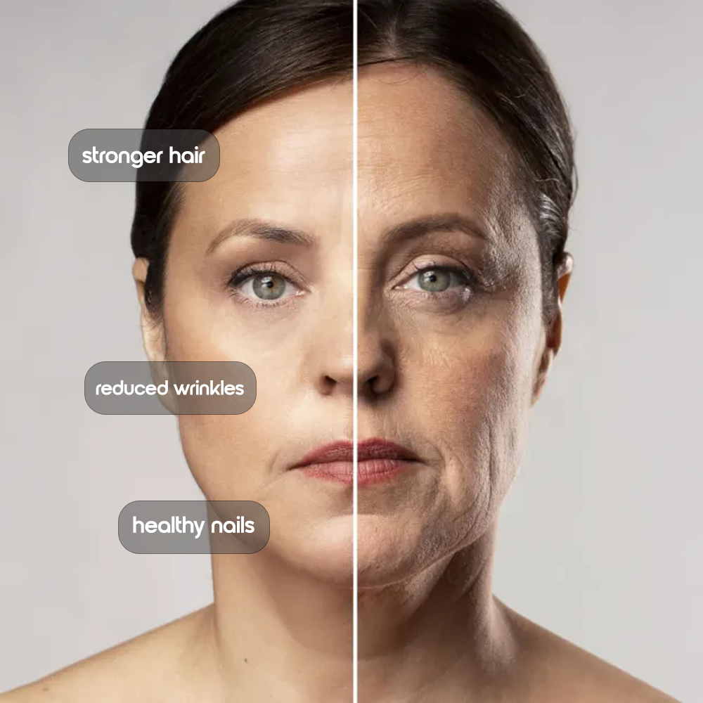 Skinly Multi-Collagen Peptides – Types I, II, III, V, and X with Hyaluronic Acid, Biotin, and Vitamin C – Unflavored